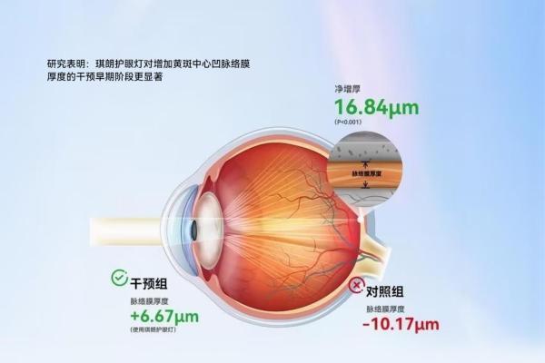 行业首个真人临床研究登国际期刊：《琪朗全光谱护眼灯被证实可延缓学龄儿童眼轴增长》 