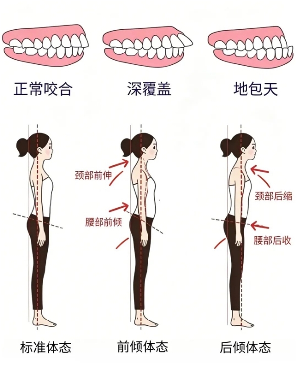 早预防 早干预 少走正畸弯路 惠州口腔医院专家呼吁正畸治疗需把握“黄金期”
