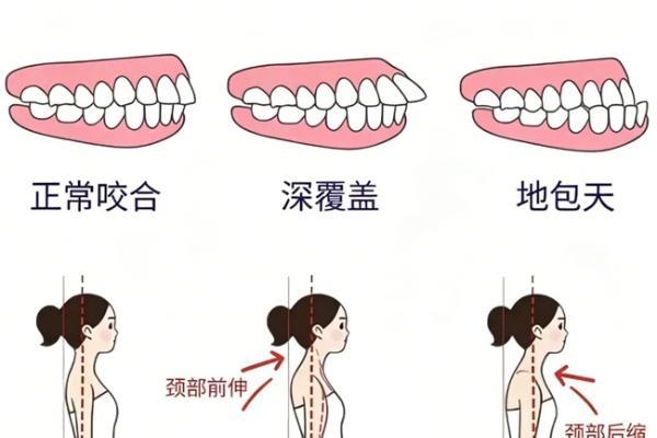 早预防 早干预 少走正畸弯路 惠州口腔医院专家呼吁正畸治疗需把握“黄金期”