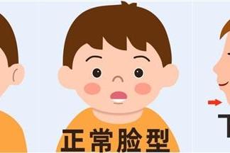 早预防 早干预 少走正畸弯路 惠州口腔医院专家呼吁正畸治疗需把握“黄金期”