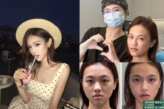 专访深圳鹏爱医疗美容医院微整主任曹童 