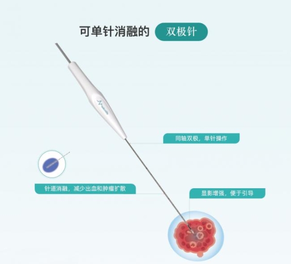 维纳刀肝癌,胰腺癌双适应症获批，纳米刀肿瘤消融进入局麻新时代 