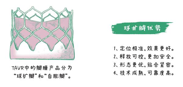 经导管主动脉瓣置换术（TAVR）手术全揭秘：从穿刺到瓣膜释放 