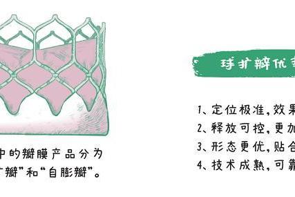 经导管主动脉瓣置换术（TAVR）手术全揭秘：从穿刺到瓣膜释放 