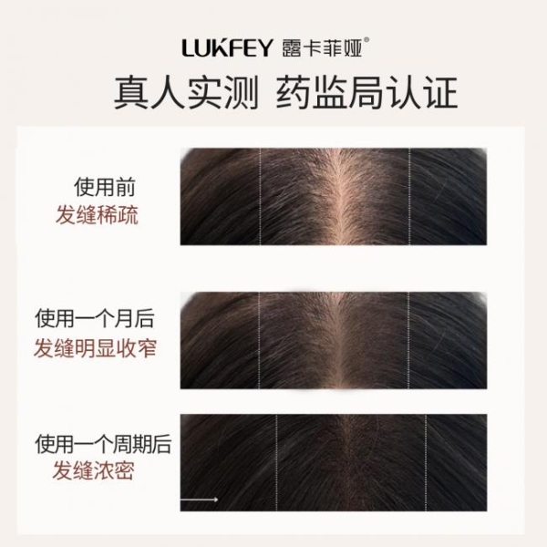 洗发水哪个牌子的质量好最好用？测评2026年口碑最好的十大防脱洗发水！ 