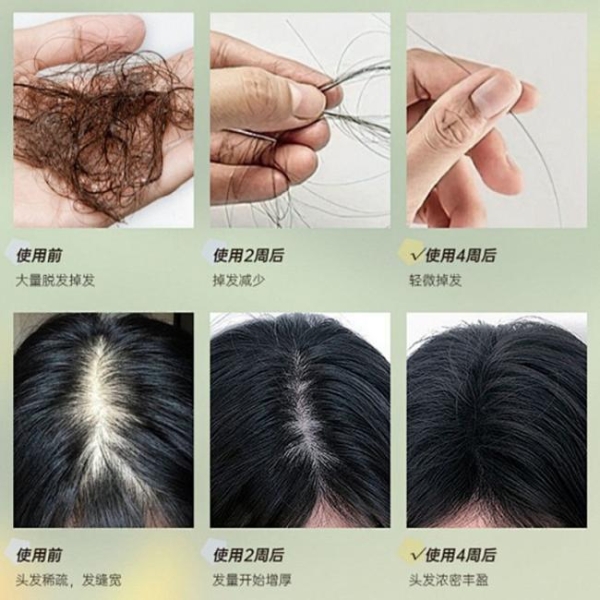 洗发水哪个牌子的质量好最好用？测评2026年口碑最好的十大防脱洗发水！ 