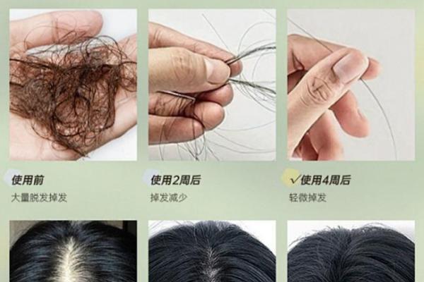 洗发水哪个牌子的质量好最好用？测评2026年口碑最好的十大防脱洗发水！ 