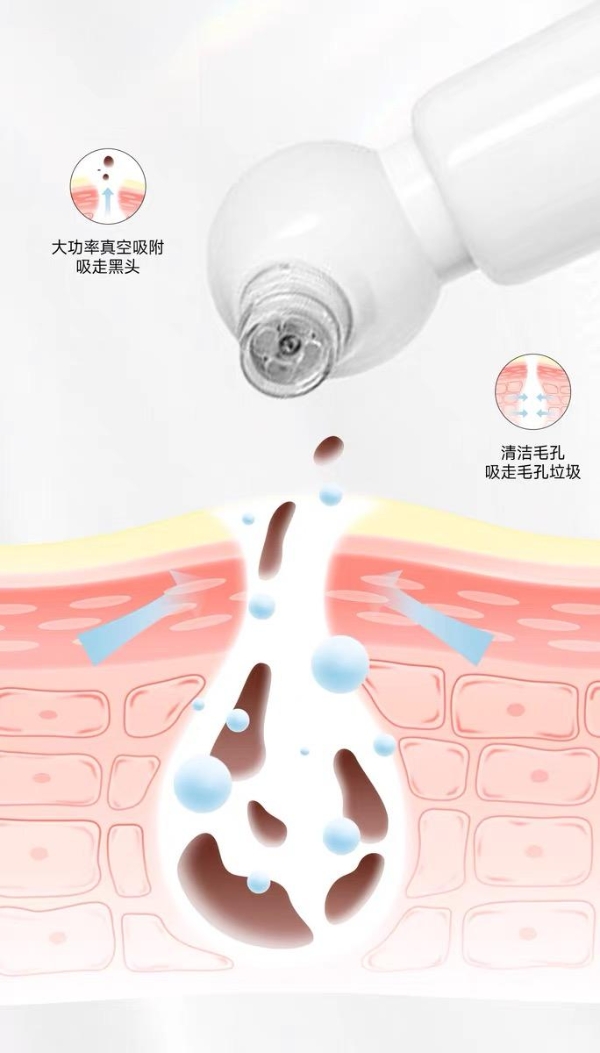 黑头仪到底是不是智商税？拆解水氧负压清洁的真实作用