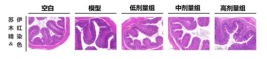御芝林获“一种组合物在制备预防或改善结肠黑变产品的应用”发明专利 