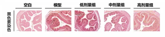 御芝林获“一种组合物在制备预防或改善结肠黑变产品的应用”发明专利 