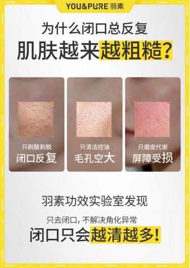 经常熬夜长闭口怎么办？以酶温和疏通不伤屏障 