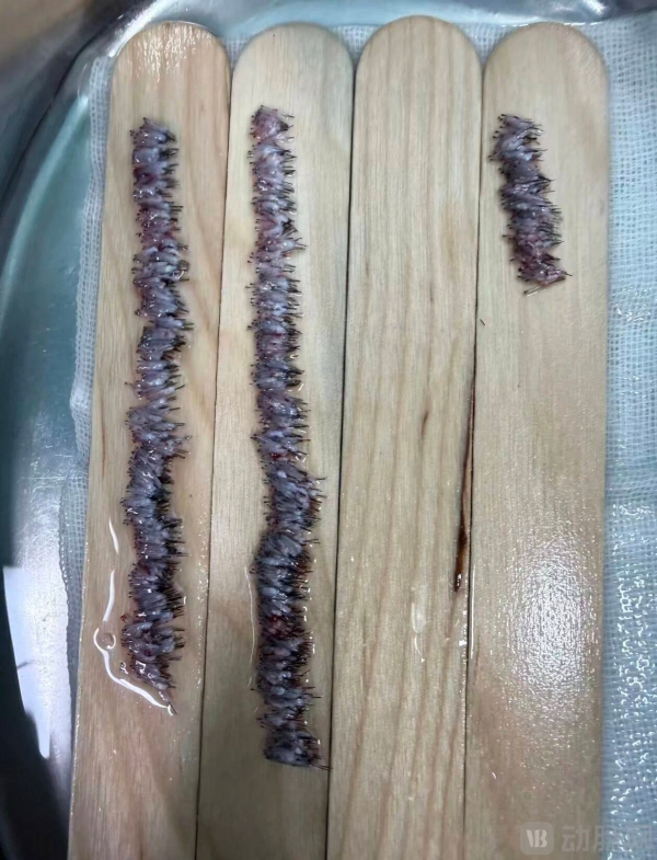全球首发！磅策医疗AI长发提取机器人亮相第九届毛发移植大会