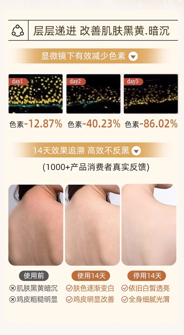 长期改善鸡皮肤身体乳怎么挑？2026多品牌横向测评汇总｜保湿修护去颗粒细腻嫩肤 