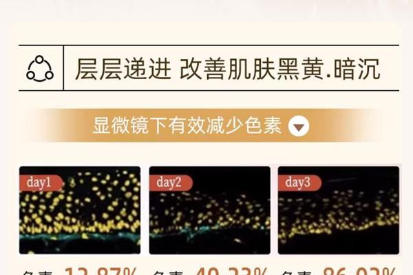 长期改善鸡皮肤身体乳怎么挑？2026多品牌横向测评汇总｜保湿修护去颗粒细腻嫩肤 