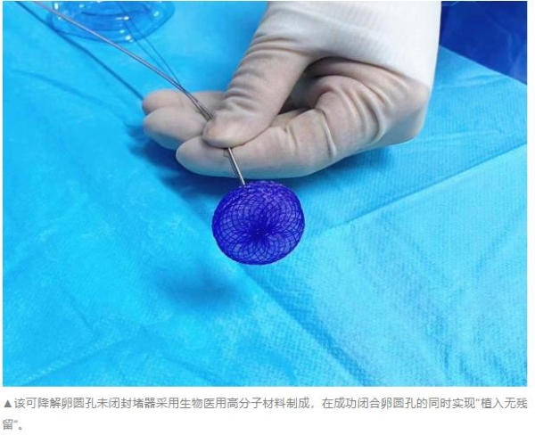 老年患者PFO介入治疗，为何更需关注“可降解”？ 