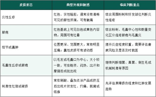 大家常说的“红肿痘”通常指什么？从红色丘疹、脓疱到深部结节，按五组线索判断 
