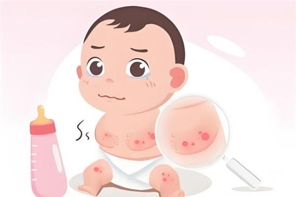 敏宝喂养避坑指南 | 抗过敏奶粉排行榜10强，肠胃娇嫩宝宝这样选