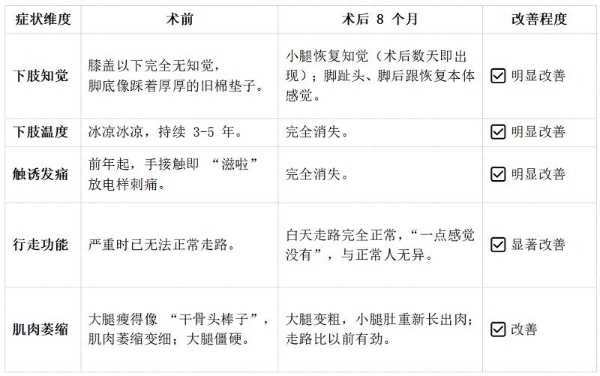 脊髓电刺激治疗下肢痛性糖尿病周围神经病变病例 