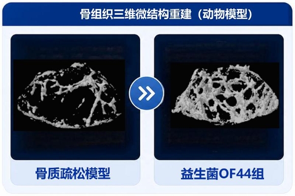 中国专利优秀奖！华大OF44益生菌双效守护女性生殖与骨骼健康 