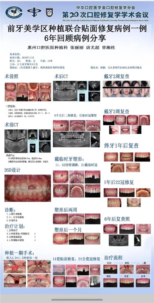 喜报 | 惠州口腔医院3份病例入选全国口腔修复大会壁报展示！ 