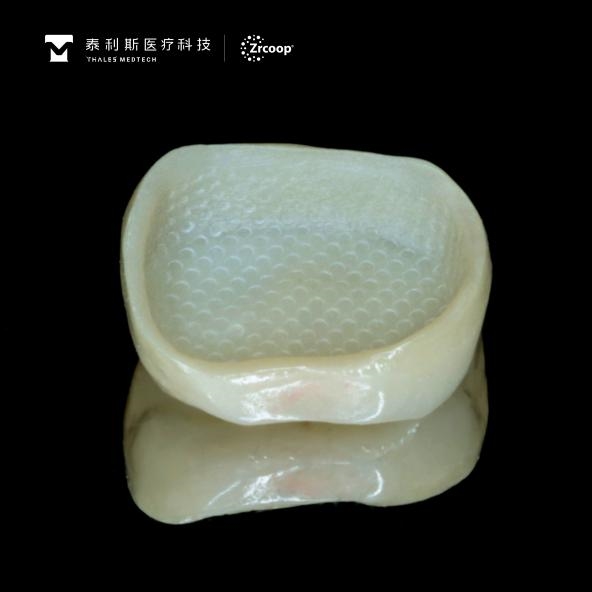 牙冠老是掉，可能是基牙太短——杭州医生用 3D 打印氧化锆破解“短冠”固位难题 