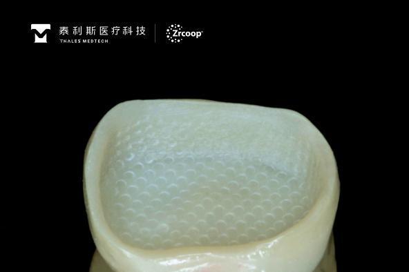 牙冠老是掉，可能是基牙太短——杭州医生用 3D 打印氧化锆破解“短冠”固位难题 