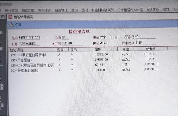 世界首次丨单针维纳刀消融门静脉癌栓——牛立志院长突破肝癌血管侵犯消融瓶颈 